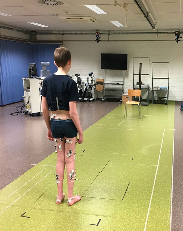 Dravet Europe | Gait impairment analysis